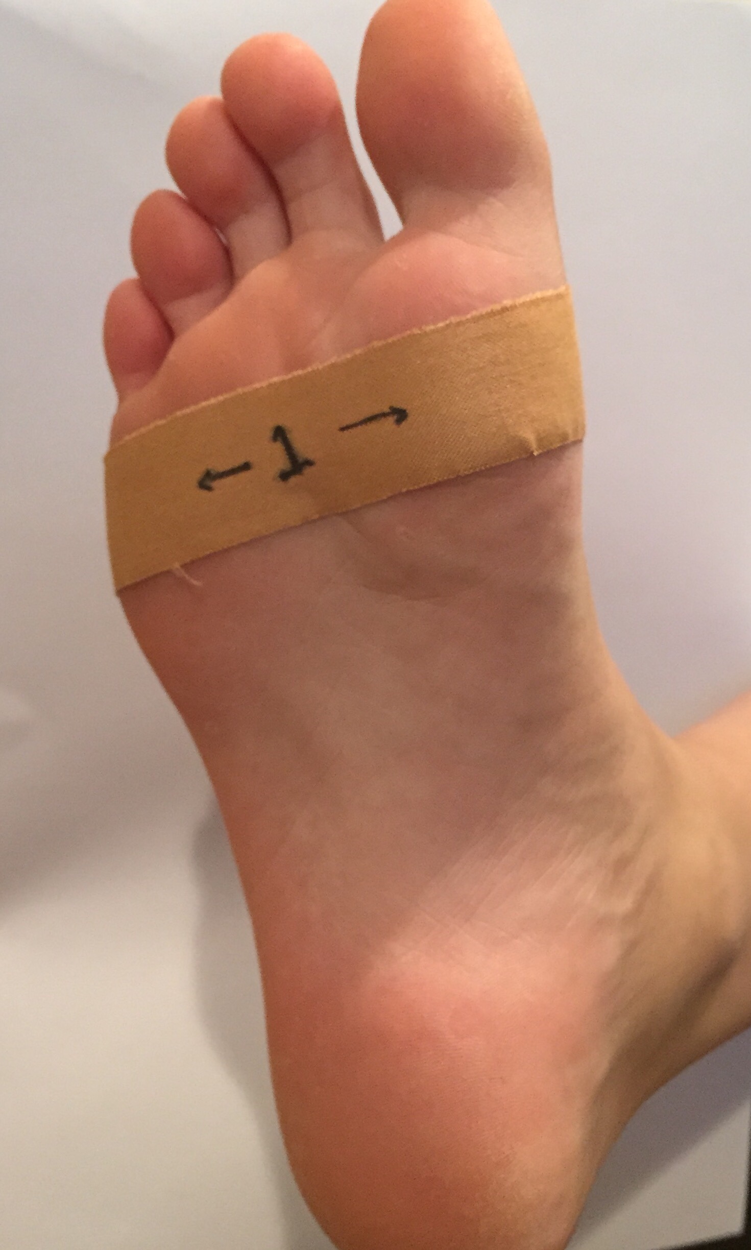 plantar fasciitis tape 1 • Physical Therapy Marketing and Personal Finance