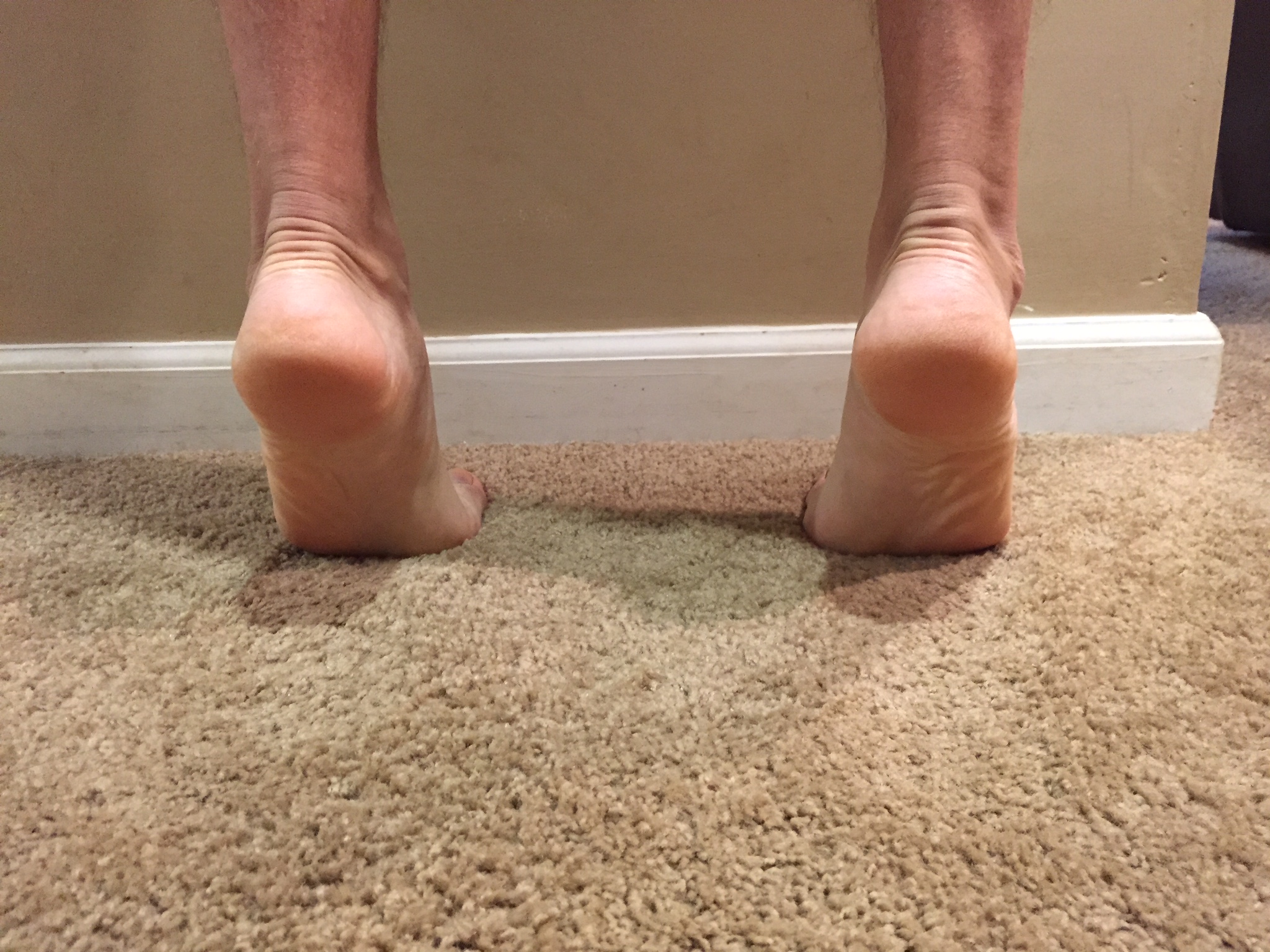 Plantar Fasciitis Treatment: How to Heal Heel Pain