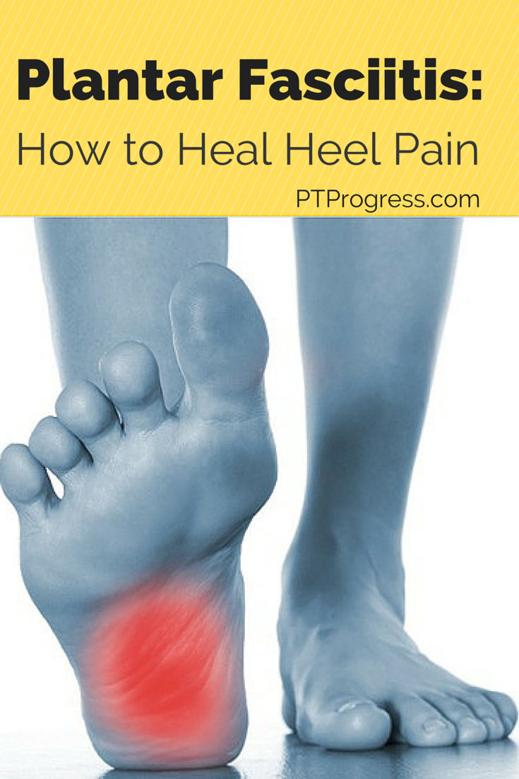 Plantar Fasciitis Treatment: How to Heal Heel Pain