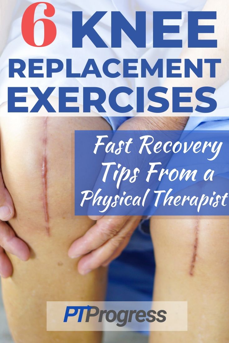 Exercises After Knee Replacement