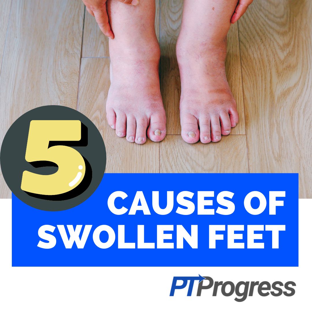 What are the reasons behind swollen feet and ankles?